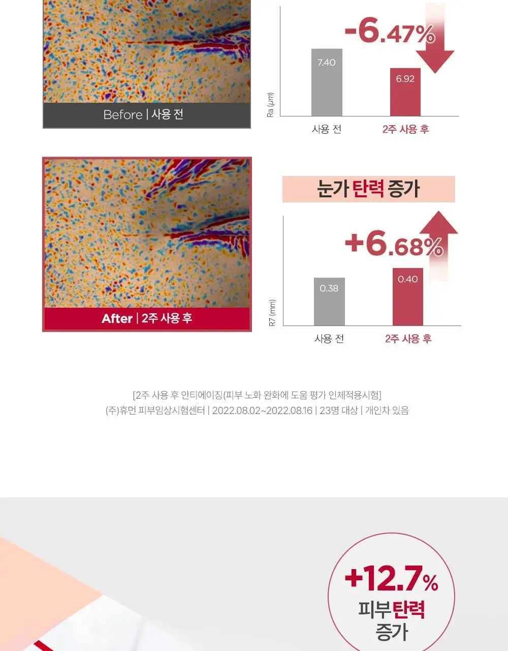 [모공탄력] 더마토리 레티날덤 밴드 마스크 4매(+1매 증정기획) 상세페이지 19